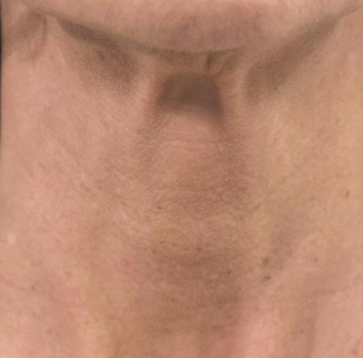 Before/After Image